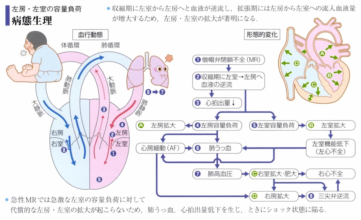貧血は他にどのように心臓に影響を与えるのでしょうか?