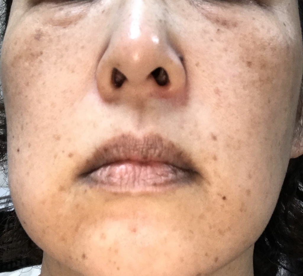 f:id:miwab:20180623141938j:plain f:id:miwab:20180623141938j:plain