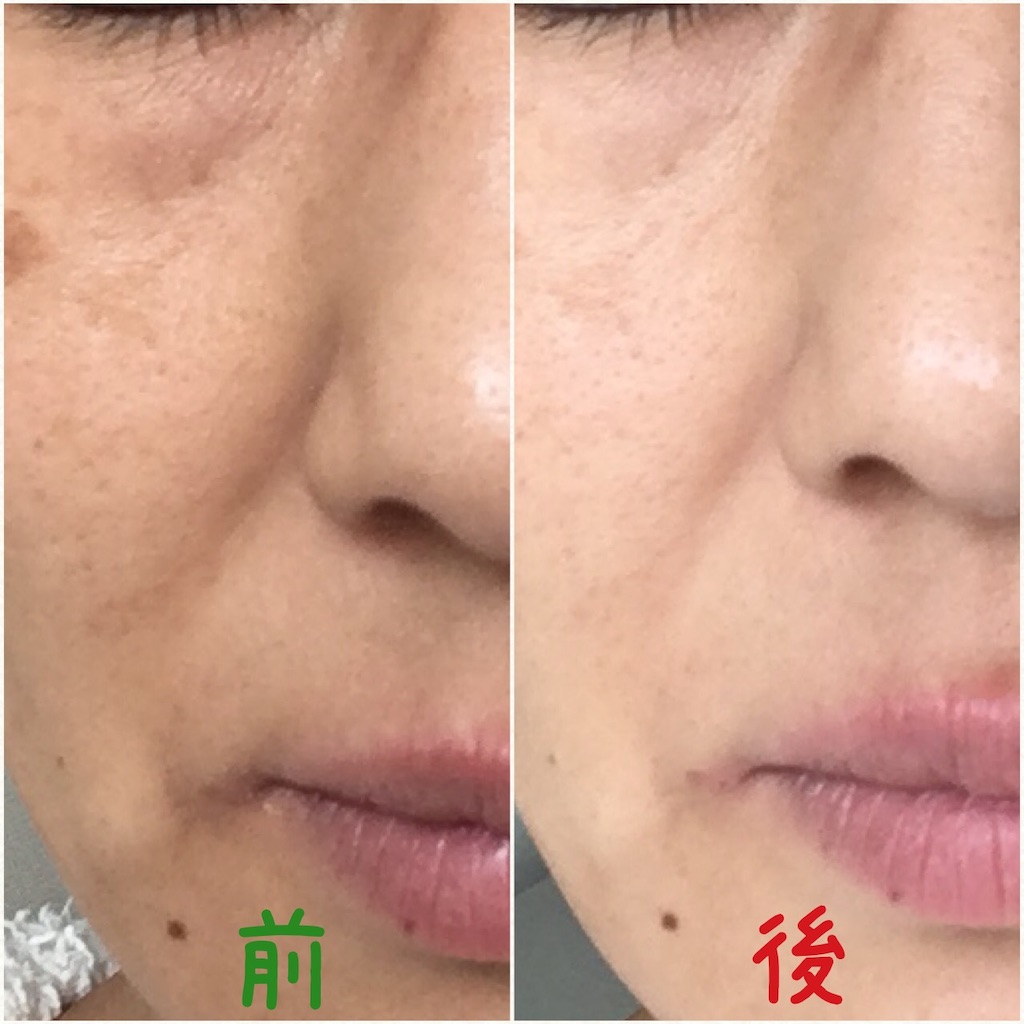 f:id:mixirio:20190712020422j:image
