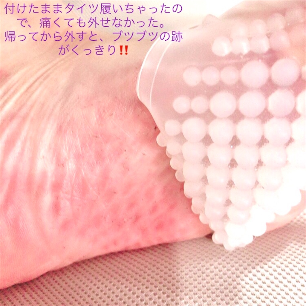 f:id:mixirio:20200313201129j:image