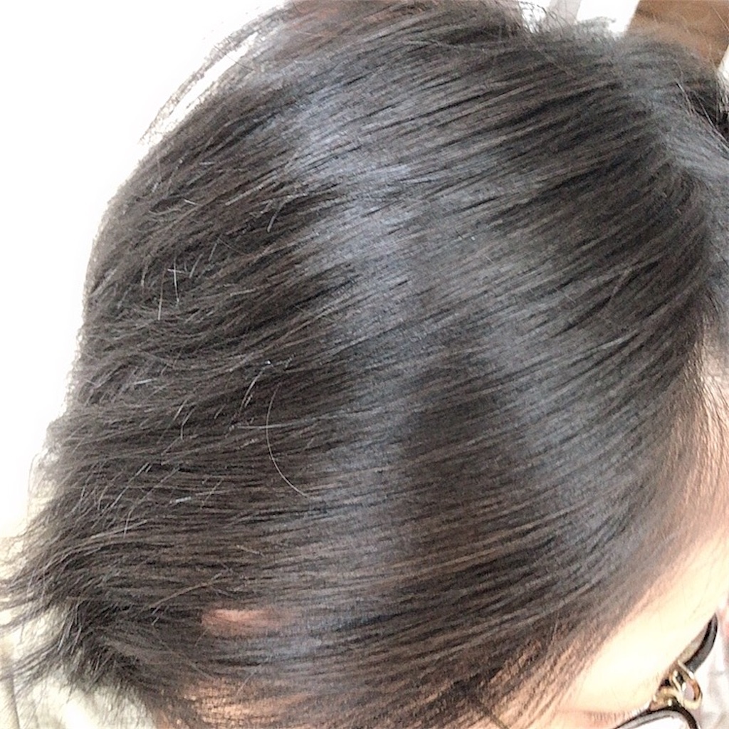 f:id:mixirio:20210713232003j:image
