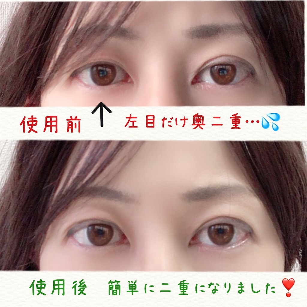 f:id:mixirio:20210728220429j:image