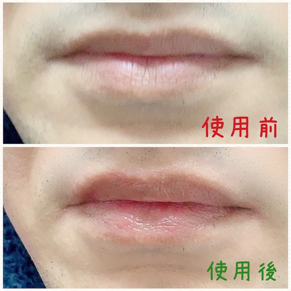 f:id:mixirio:20221029191012j:image