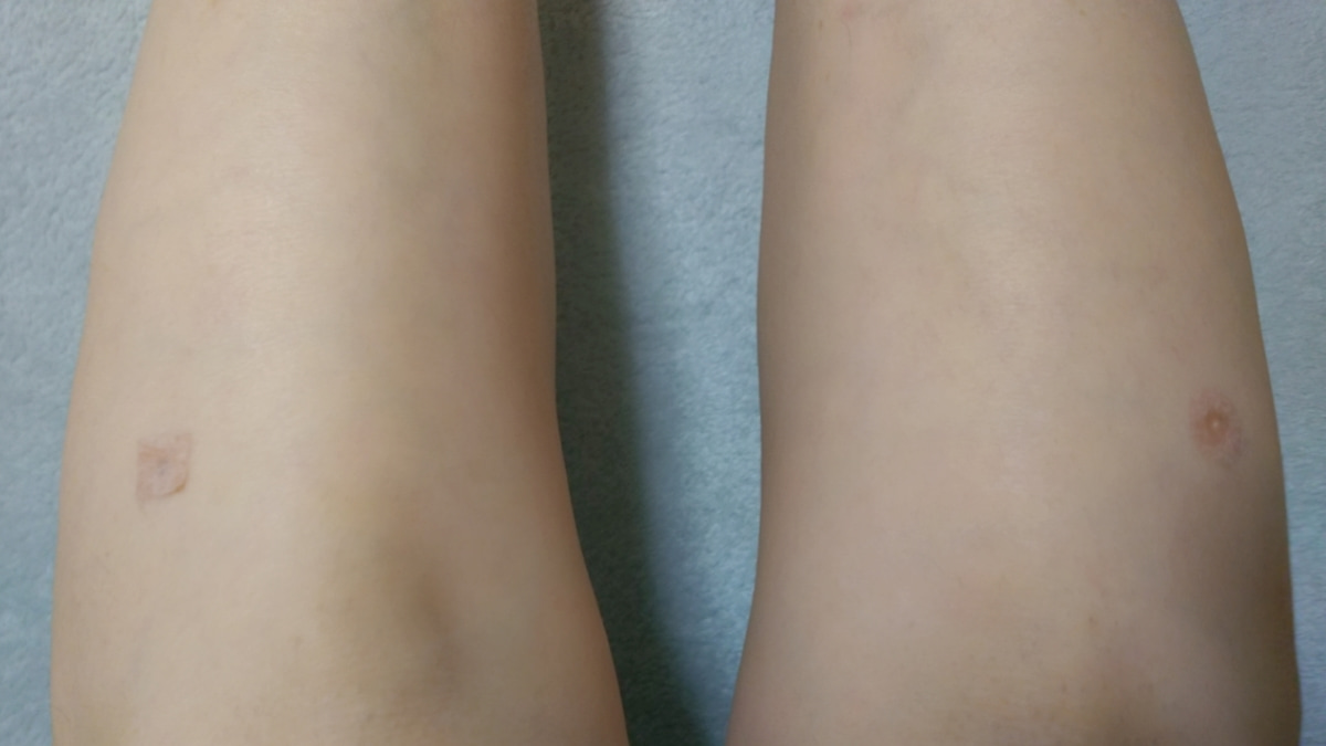 f:id:miyarock:20200519012614j:plain