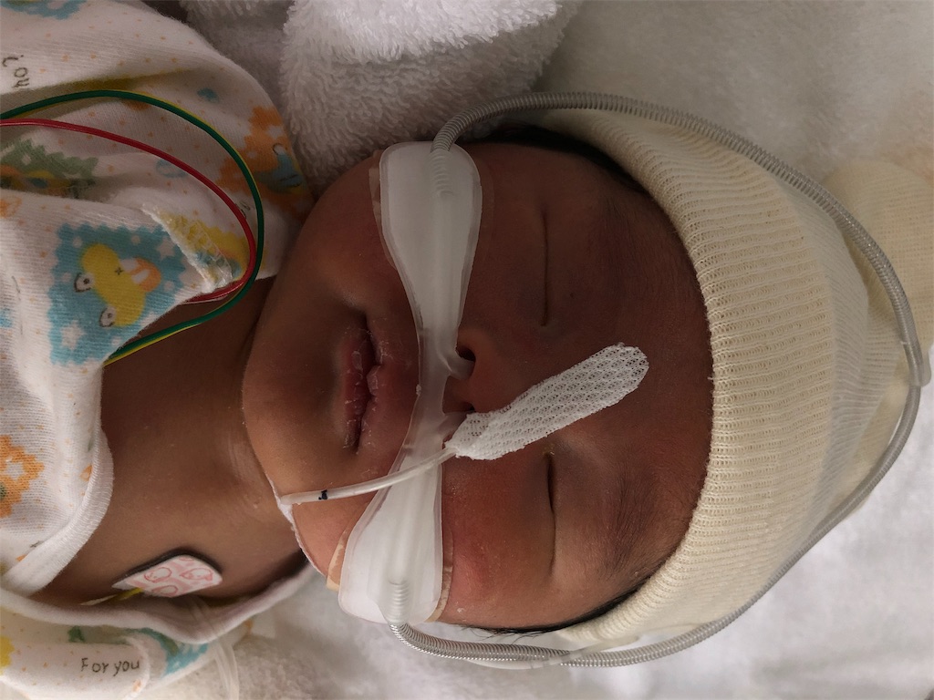 f:id:miyuku:20190723182850j:image f:id:miyuku:20190723182850j:image
