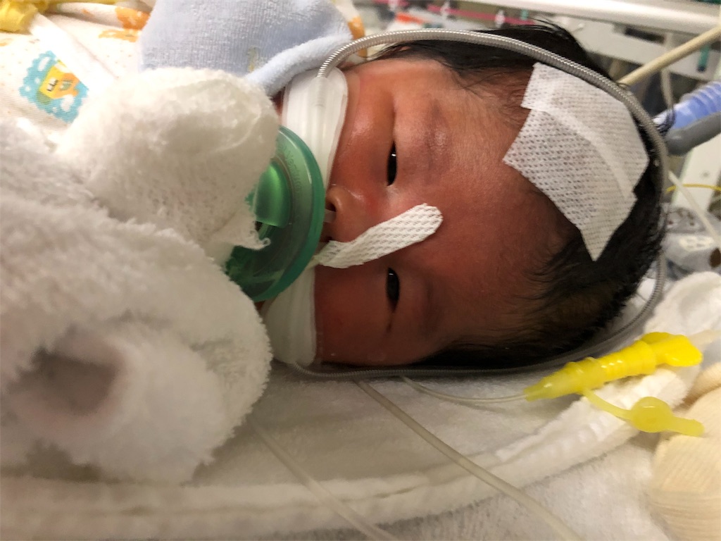 f:id:miyuku:20190724052201j:image f:id:miyuku:20190724052201j:image