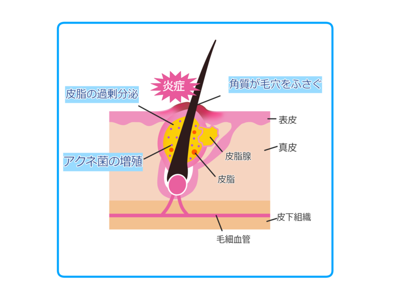f:id:mizukikuga000:20200204213835p:plain f:id:mizukikuga000:20200204213835p:plain