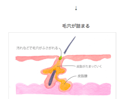 f:id:mky1995:20170504171753p:plain f:id:mky1995:20170504171753p:plain