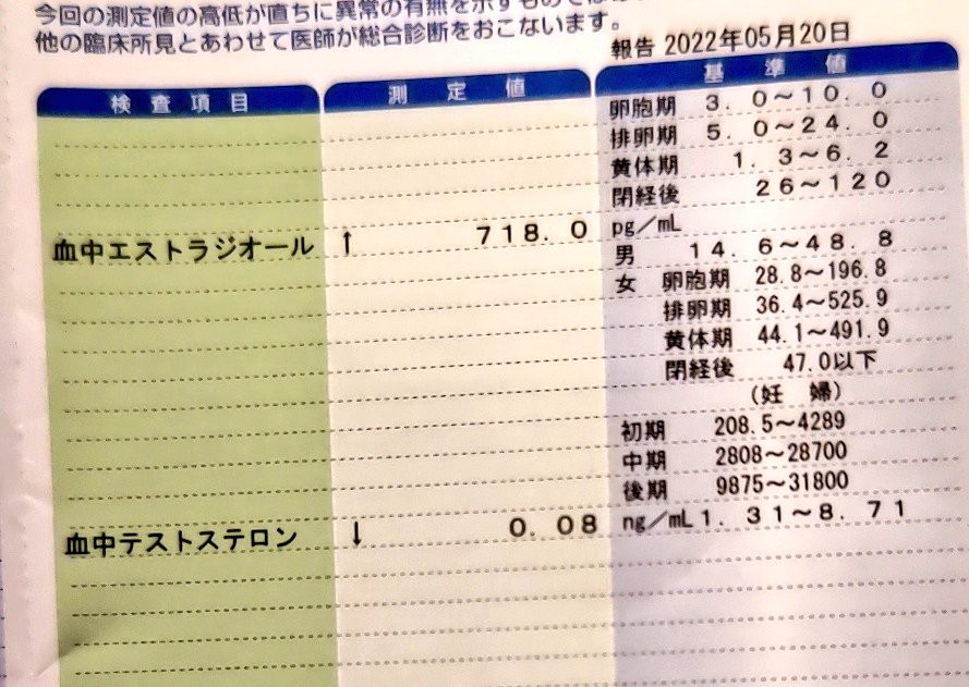 f:id:mkyokyo:20220729172516j:image