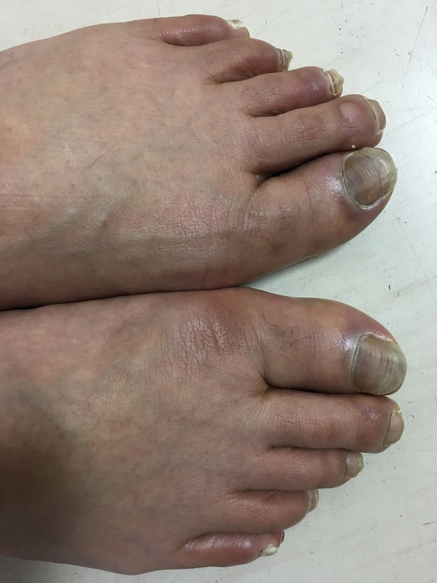 f:id:mm-higuchi99:20200606154048j:plain f:id:mm-higuchi99:20200606154048j:plain