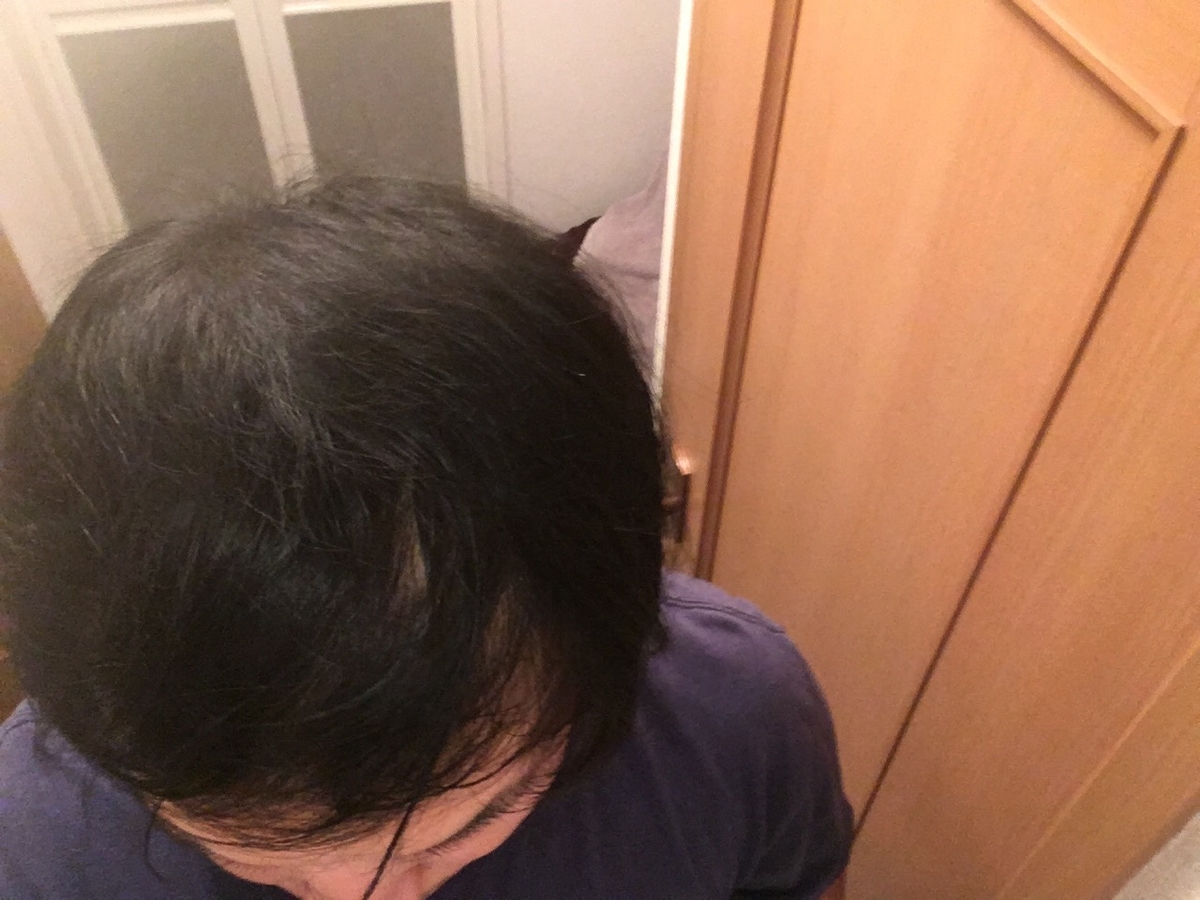 f:id:mnhy613:20190604150811j:plain f:id:mnhy613:20190604150811j:plain