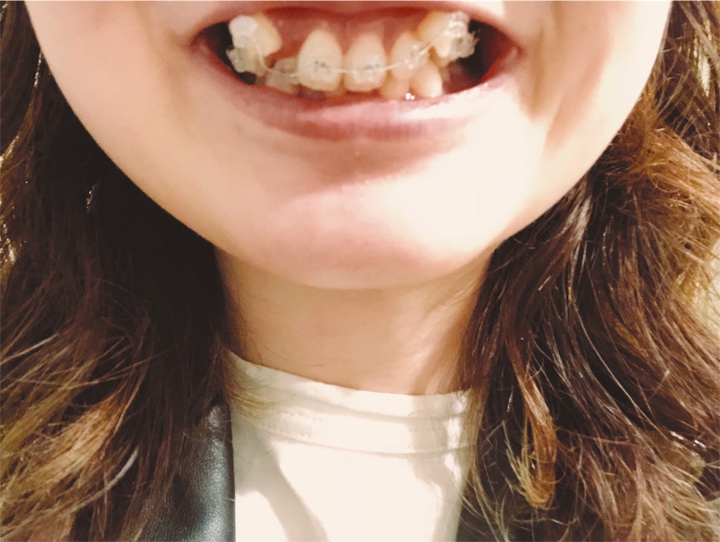 f:id:mnkm7:20180507203347j:image f:id:mnkm7:20180507203347j:image