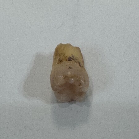Right second molar... It's brownish because it served me well for 60 years.