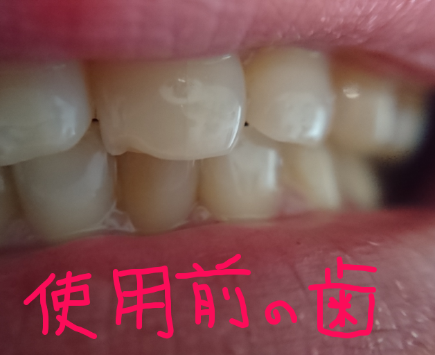f:id:mo88mo:20170519135817p:plain