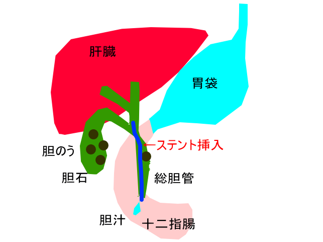 f:id:mocchipa:20200201154948p:plain