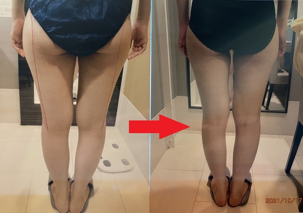 エルセーヌの足痩せ体験エステのBefore、After