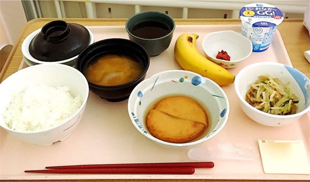 f:id:mochi-log:20180716212231j:image f:id:mochi-log:20180716212231j:image