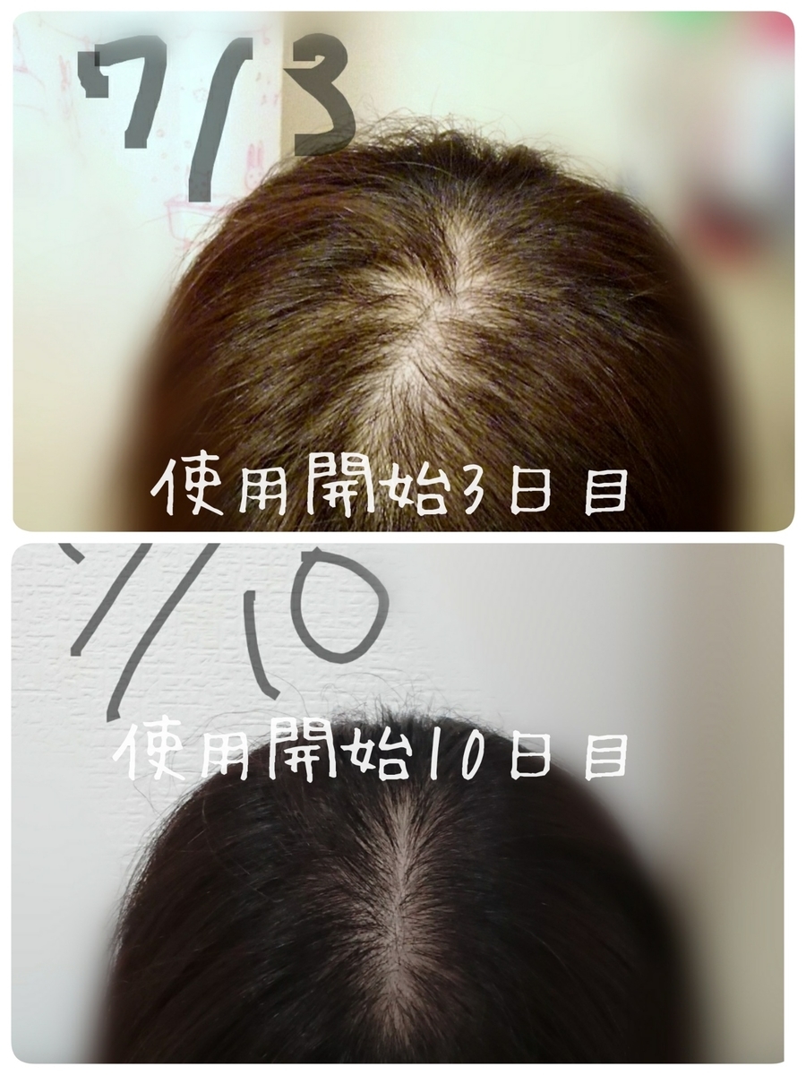 f:id:mocomchan:20200711134517j:plain f:id:mocomchan:20200711134517j:plain