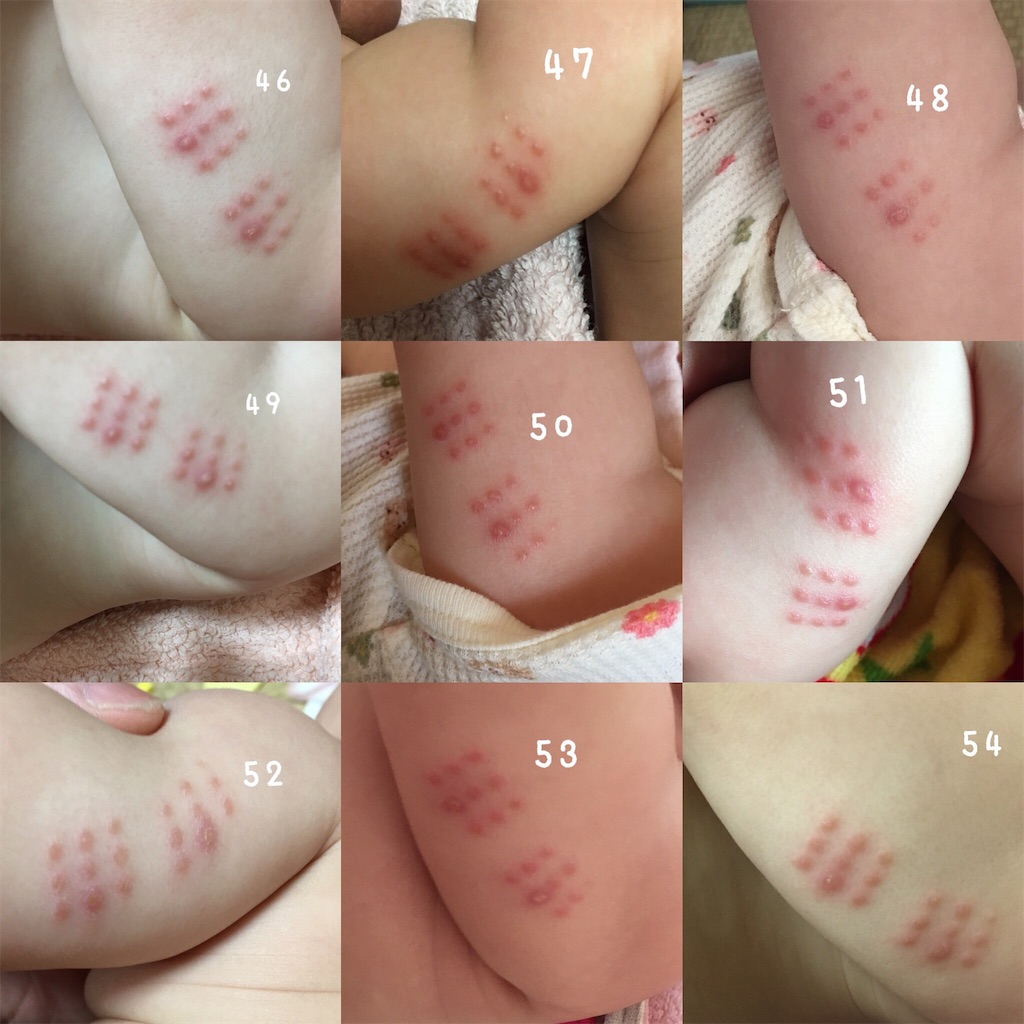 g接種後の反応は 54日間の経過写真記録 もぐもぐ Diary