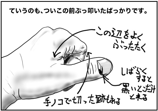 指ぶっ叩く
