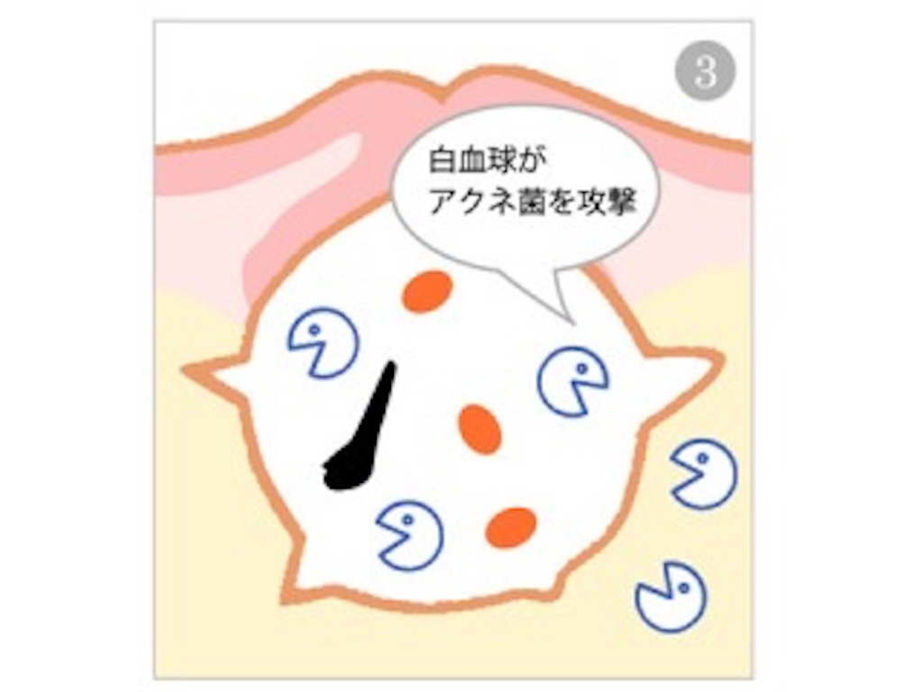 f:id:mokyu0929:20180515152200j:image f:id:mokyu0929:20180515152200j:image