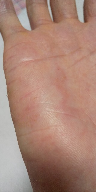 f:id:molgarden:20210623184235j:image f:id:molgarden:20210623184235j:image