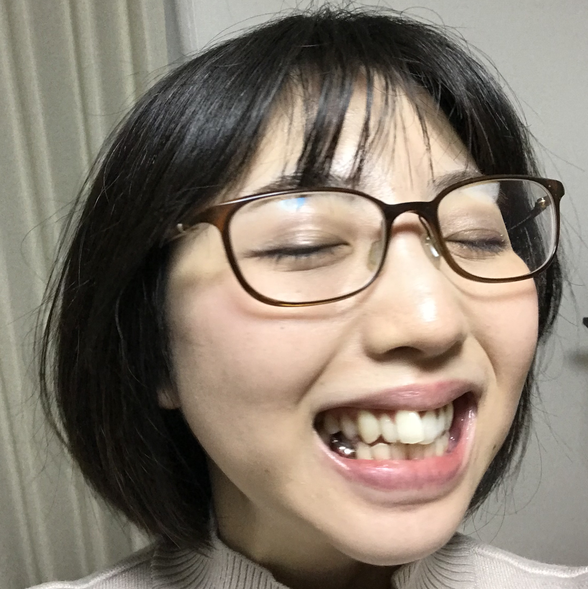【銀座デンタルホワイト】歯の汚い女がホワイトニングに行ってみた結果…! 僕の傘を探しに 【銀座デンタルホワイト】歯の汚い女がホワイトニングに行ってみた結果…! 僕の傘を探しに