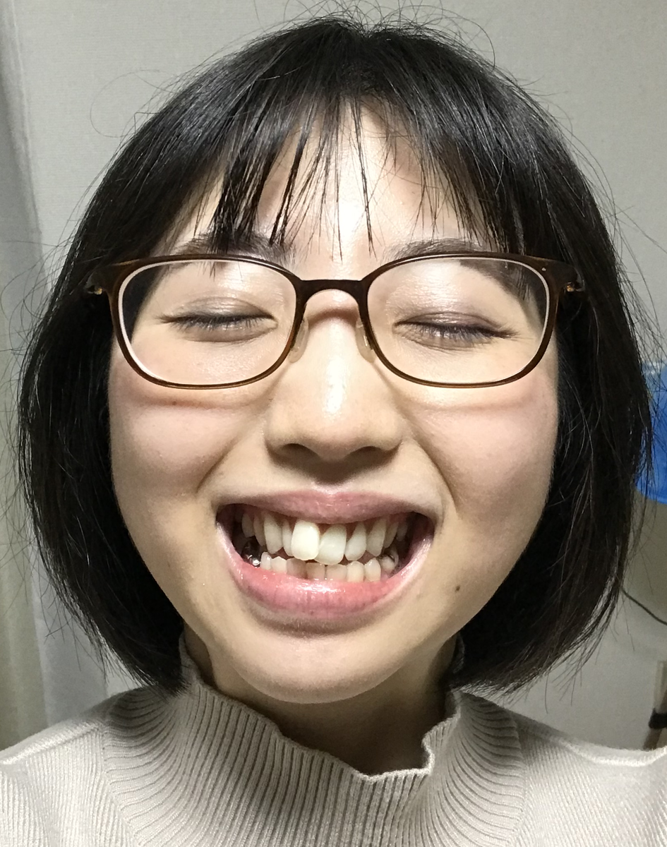 【銀座デンタルホワイト】歯の汚い女がホワイトニングに行ってみた結果…! 僕の傘を探しに 【銀座デンタルホワイト】歯の汚い女がホワイトニングに行ってみた結果…! 僕の傘を探しに