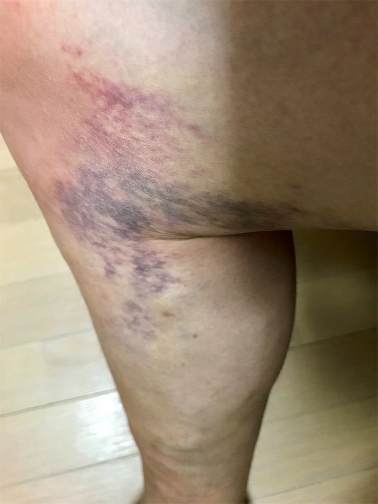 f:id:momomodoki:20180709224712j:image