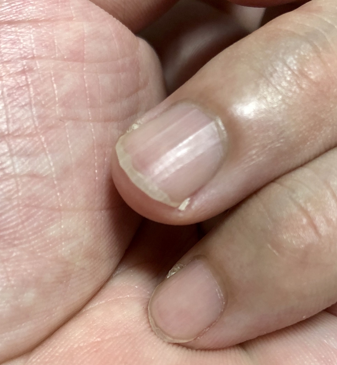 たまに出てくる困ったやつ デキる子もどきの自己満備忘録