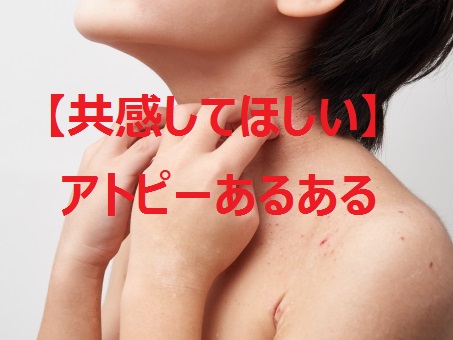 共感してほしい アトピーあるある早く言いたい 日曜日のはやぶさ 盛大に何も始まらない