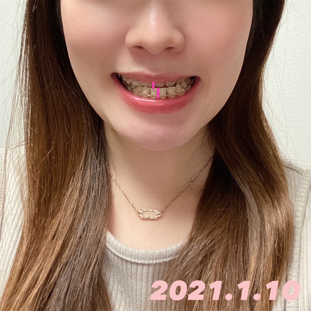 f:id:monaka_kyosei:20210111194446j:image f:id:monaka_kyosei:20210111194446j:image