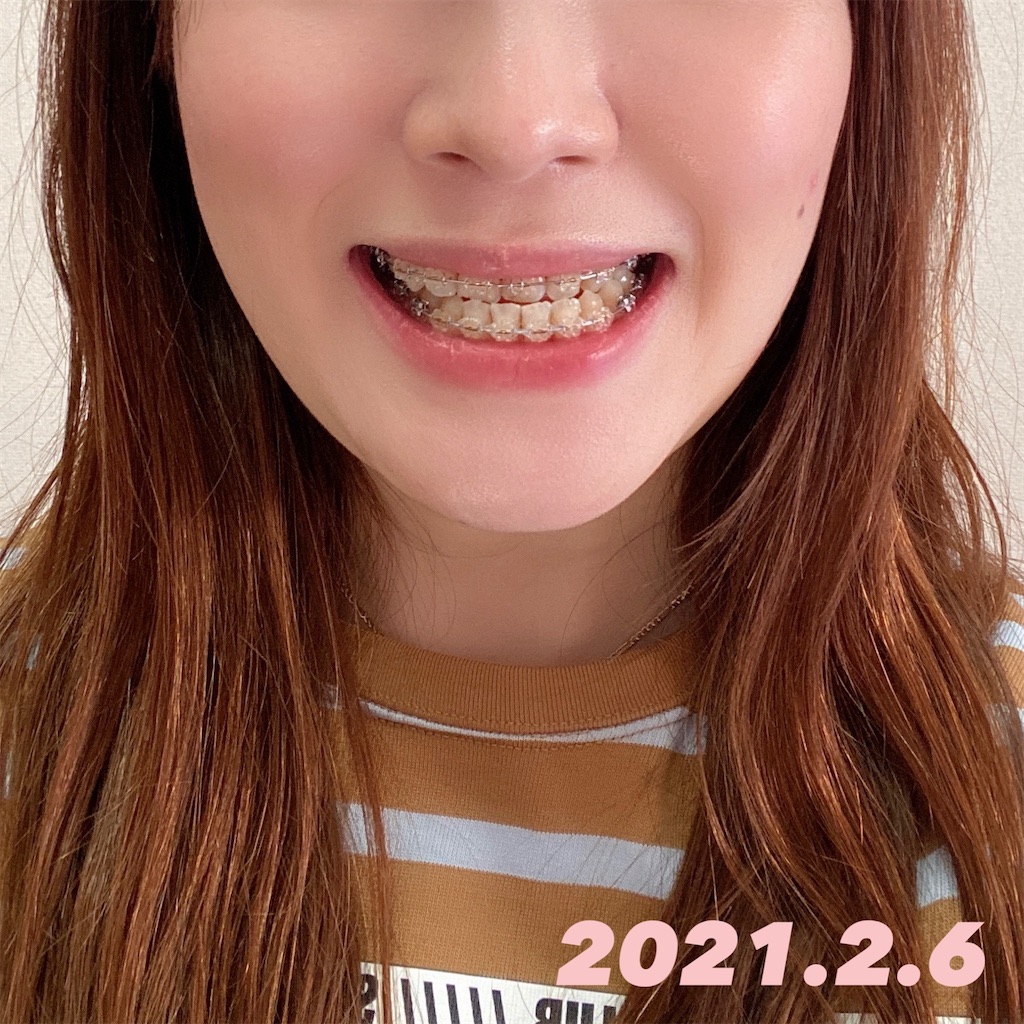 f:id:monaka_kyosei:20210207164023j:image f:id:monaka_kyosei:20210207164023j:image