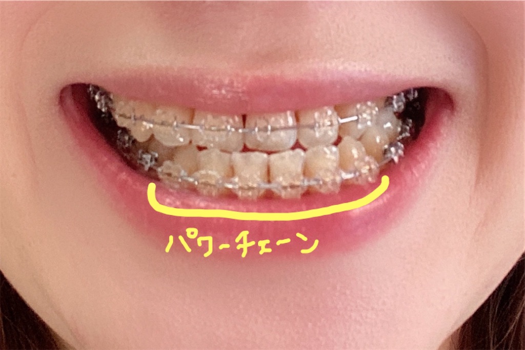 f:id:monaka_kyosei:20210207164233j:image f:id:monaka_kyosei:20210207164233j:image