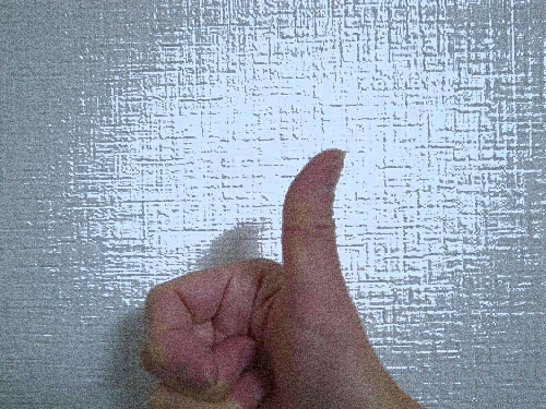 バネ指になってステロイド注射とリハビリをした話 Monparis S Blog