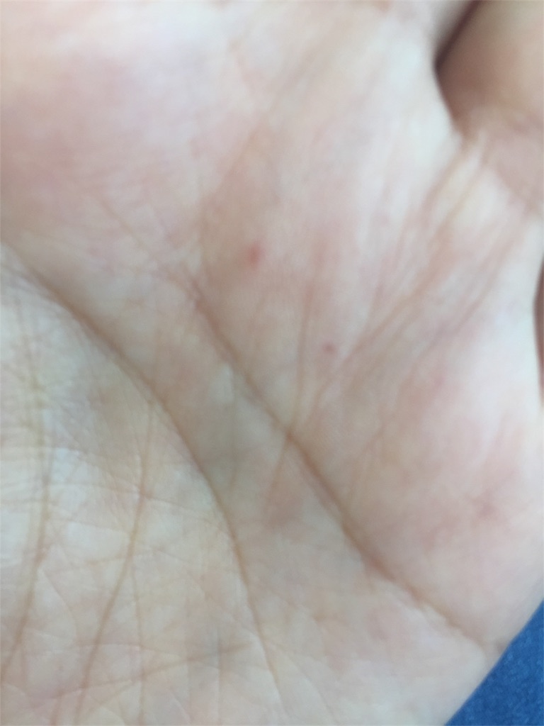 f:id:mothersnote:20170706115355j:image