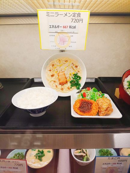 ミニラーメン からあげの定食がおススメ 鹿児島大学病院食堂 鹿児島市桜ケ丘 食べる 寝る 考える