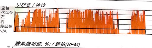 f:id:mraka2015:20180205100159j:image