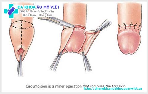 f:id:mrtrong181:20180604182945j:plain