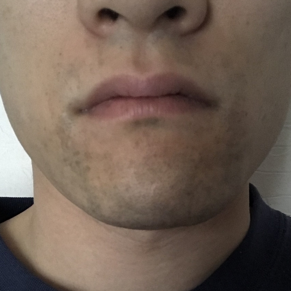 f:id:msetsu:20190105154407j:plain f:id:msetsu:20190105154407j:plain