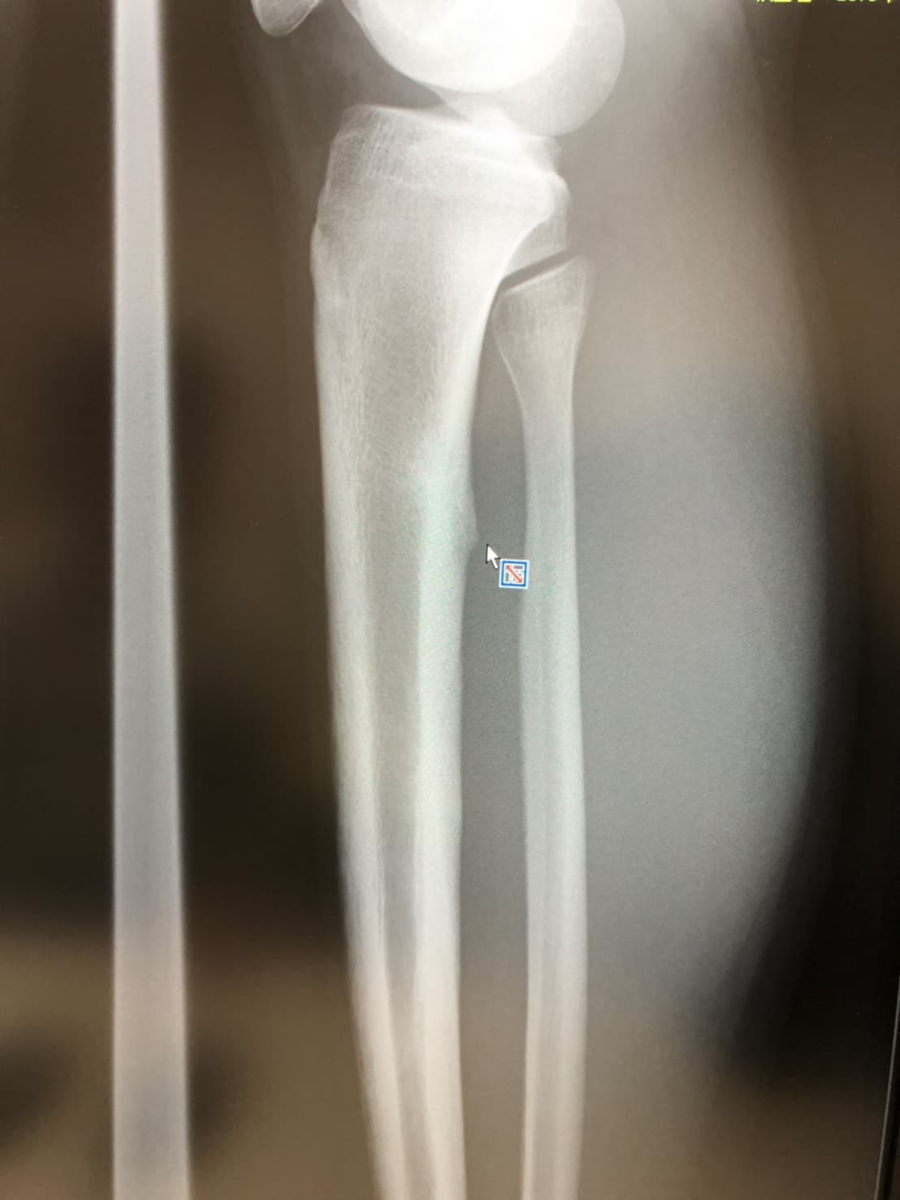 f:id:msx3:20200318135947p:plain f:id:msx3:20200318135947p:plain