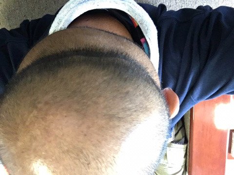 f:id:mtrue:20170829230513j:plain