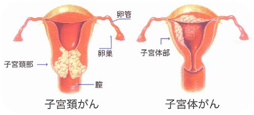 f:id:mtrue:20180309220803j:plain