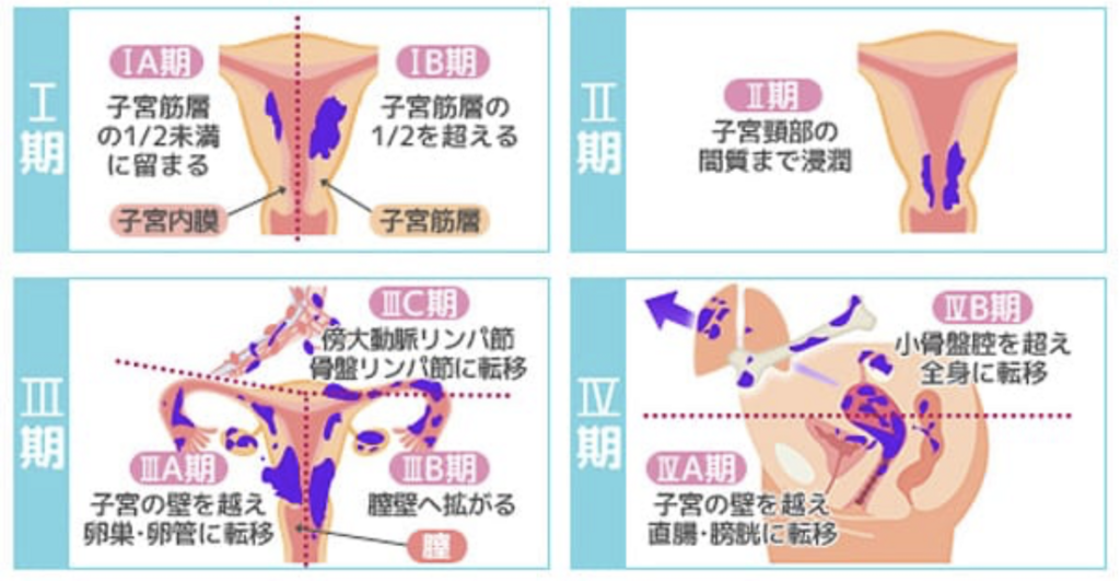 f:id:mtrue:20180309221445p:plain