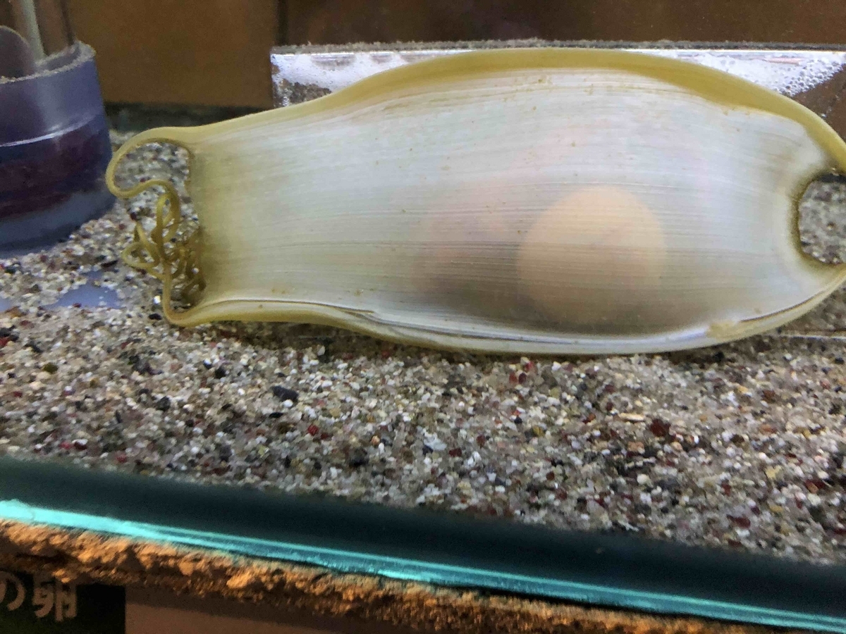 新しい目の錯覚で脳波が見える