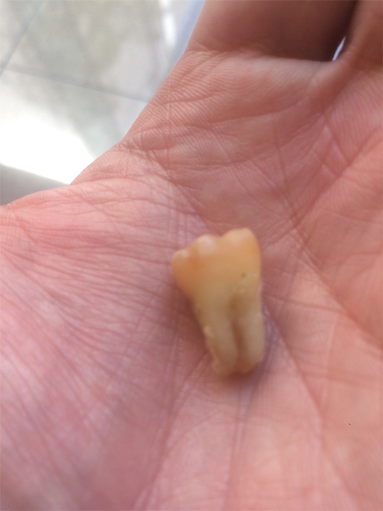 f:id:mucci:20170329053504j:image