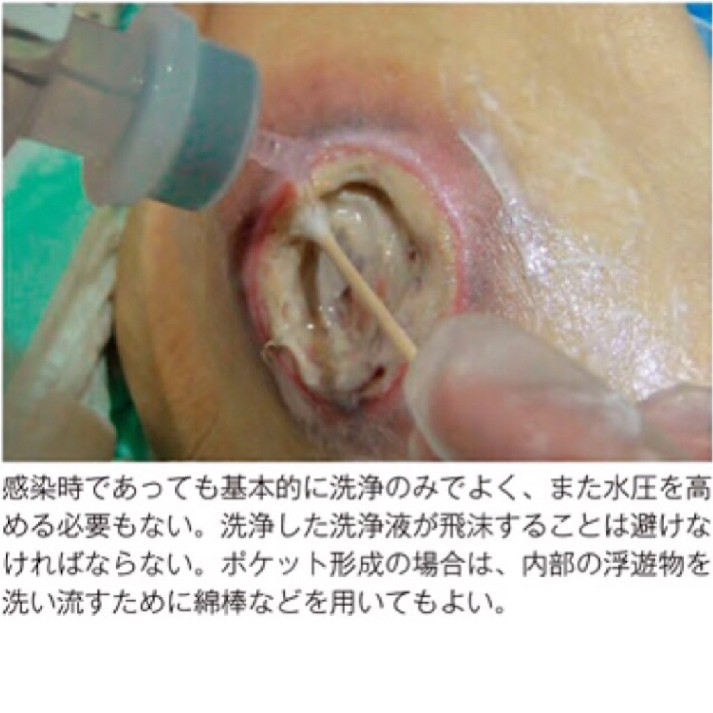 f:id:munazouchan48:20210904140804j:image