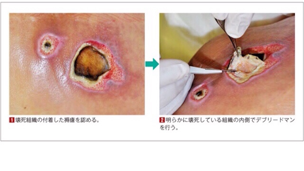 f:id:munazouchan48:20210904141250j:image