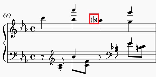 楽譜のかっこ 点字楽譜はじめました