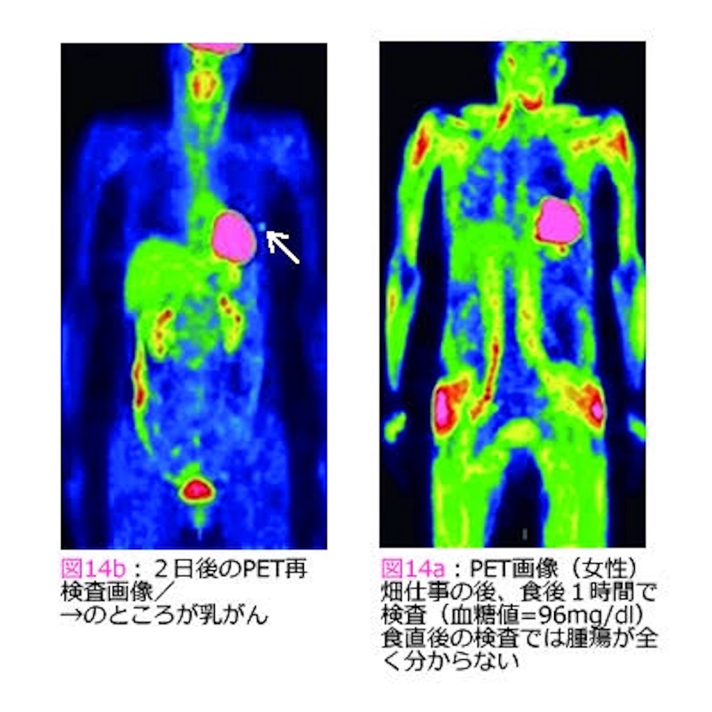 f:id:mutsukichikun:20190509120333j:image